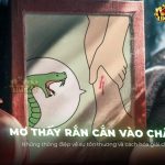 giac-mo-thay-ran-can-vao-chan-diem-bao-gi